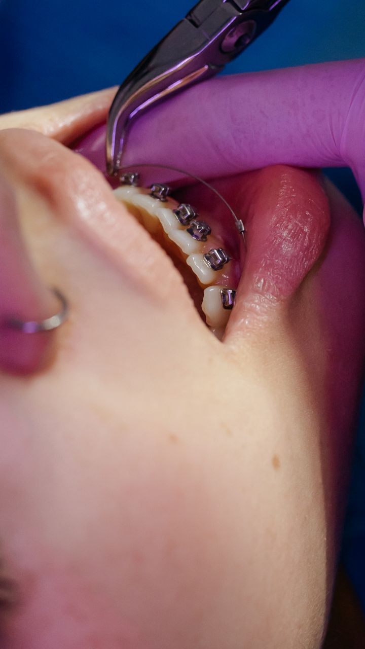 Tratamento odontológico na Clínica Fictícia